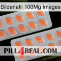 Sildenafil 100Mg Images 27